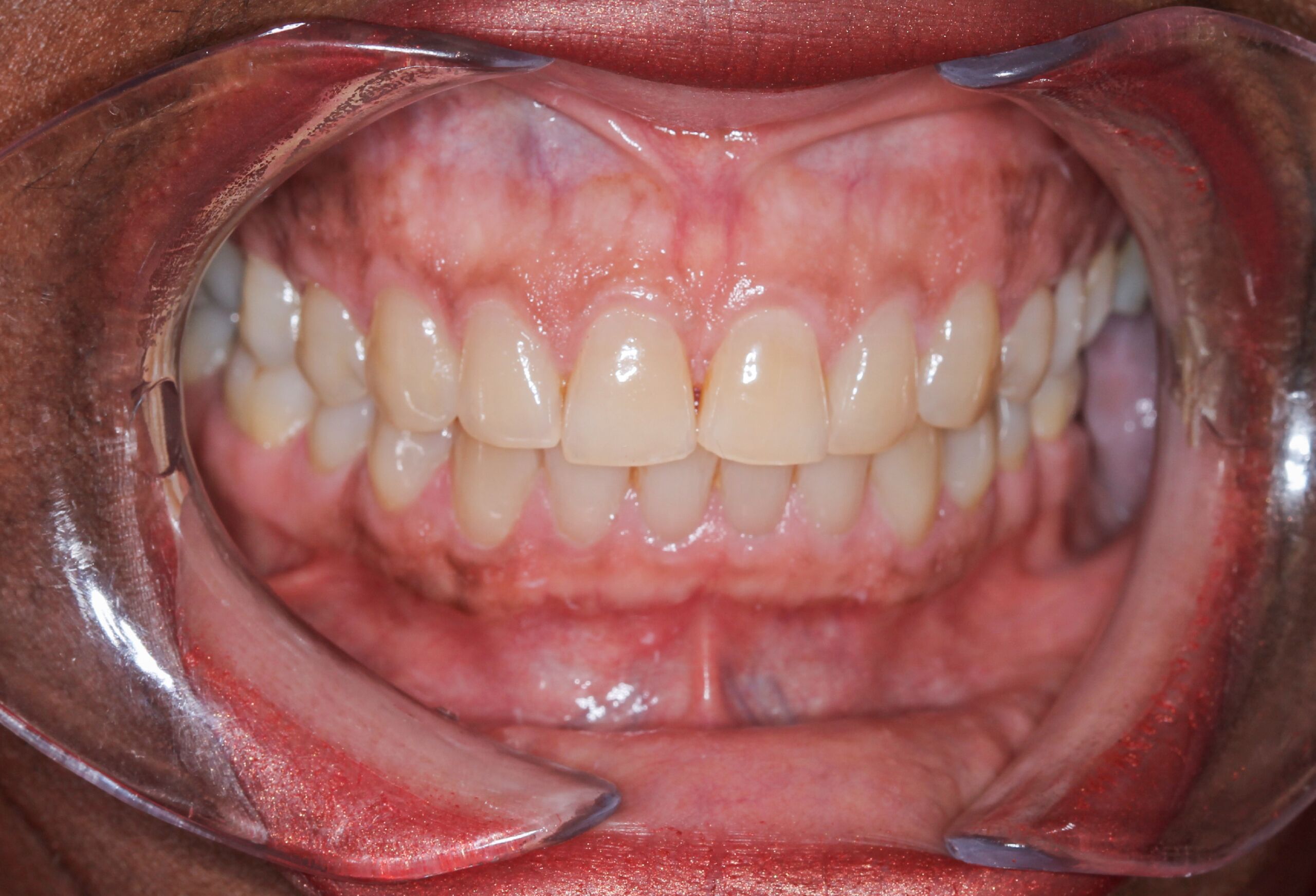 hygienist north london