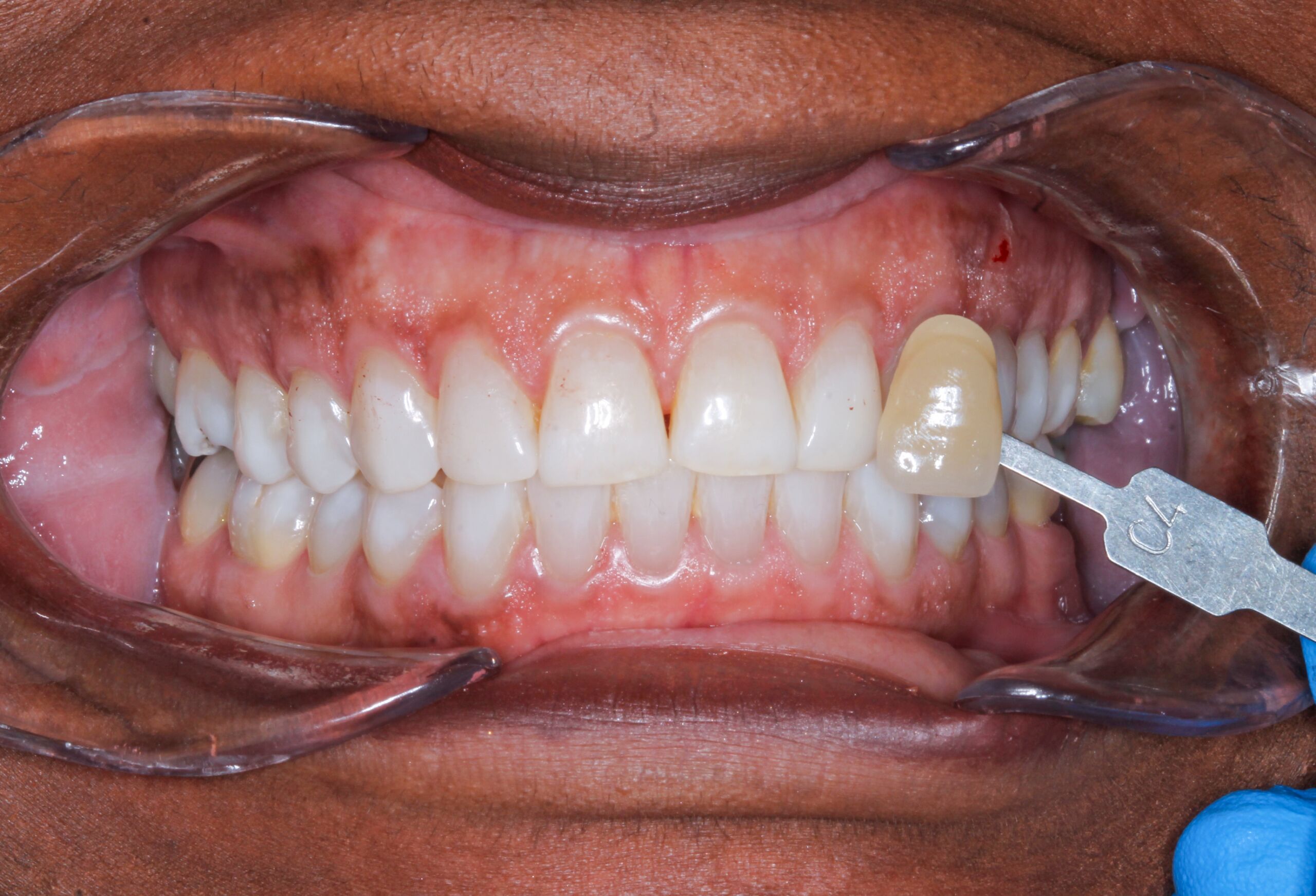 dental hygienist uk cost