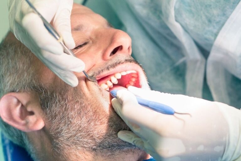 all on four dental implants